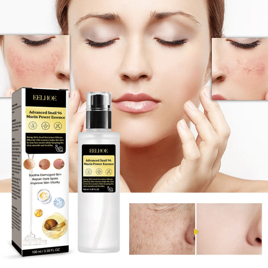 Snail Anti Wrinkle Serum Reduce Fine Line Shrinking Pore Hydrating Moisturize Rejuvenation Anti Aging Whitening Collagen Essence